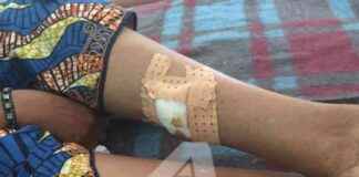 Overwhelmed Ndosho Hospital in Goma by 250 Injured: RDC-Goma Situation overwhelmed-ndosho-hospital-in-goma-by-250-njured-rdc-goma-situation