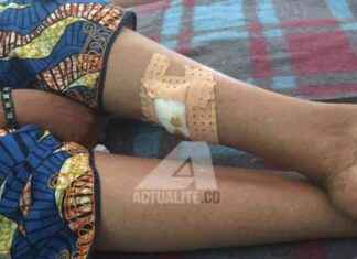 Overwhelmed Ndosho Hospital in Goma by 250 Injured: RDC-Goma Situation overwhelmed-ndosho-hospital-in-goma-by-250-njured-rdc-goma-situation